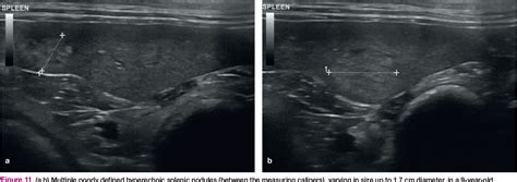 Figure From Feline Abdominal Ultrasonography Whats Normal Whats