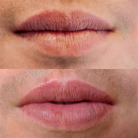 Lip Blushing Aandw Clinic