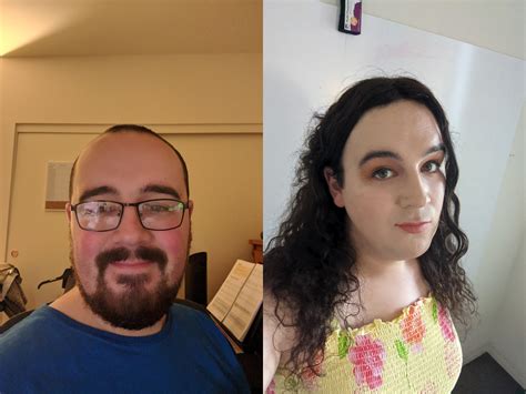 ~6 Months Pre Hrt To ~12 Months On E Loving My Look More Than Ever And I Feel Amazing R