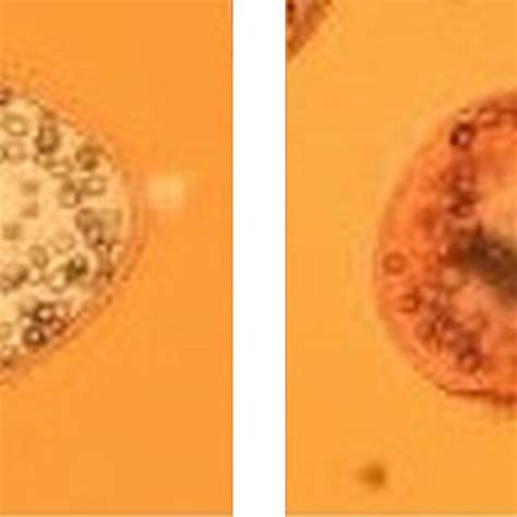 In Vitro Effects Of Formononetin Formo On Hydatid Cyst Protoscoleces