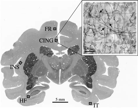 Nontropic Actions Of Neurotrophins Subcortical Nerve Growth Factor