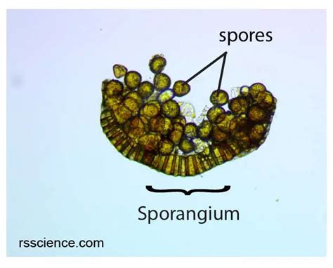 Fern Spores Under A Microscope Rs Science