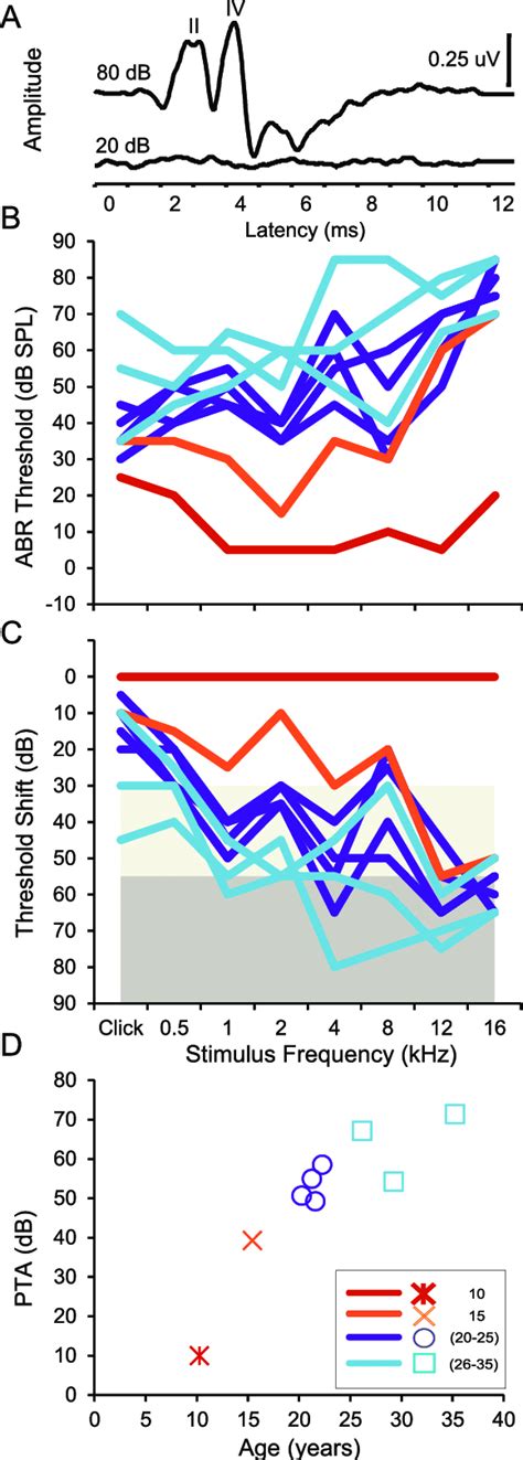 Auditory Brainstem Response Abr Measurements Of Age Related Hearing Download Scientific