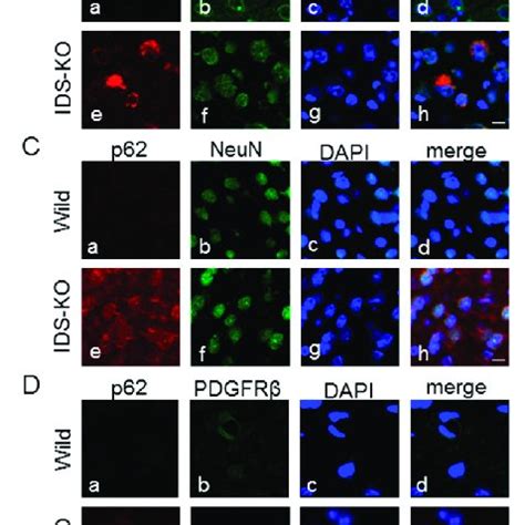 Double Immunofluorescence Staining With The Indicated Pairs Of