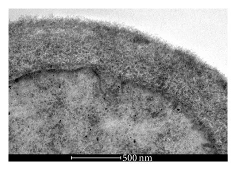 Transmission Electron Microscopy Of C Albicans Fluconazole Resistant