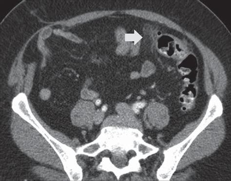 Scielo Brasil What Radiologists Should Know About Tomographic