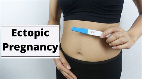 Ectopic Pregnancy What Every Woman Needs To Know Youtube