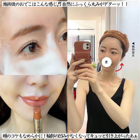 まぃまぃさんのインスタグラム写真 まぃまぃinstagram「2023夏／ Myスキンケアまとめ📝 先日ストーリーで ヒアルロン