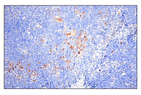 Phospho SLP 76 Ser376 E3G9U XP Rabbit MAb BSA And Azide Free