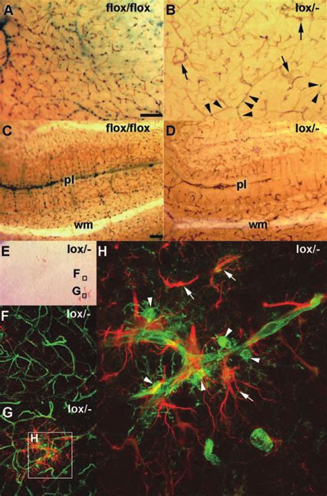 Reduced Microvessel Density Increased Microvessel Diameter