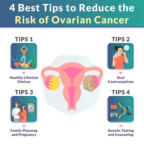 4 Best Tips To Reduce The Risk Of Ovarian Cancer Sso Hospital