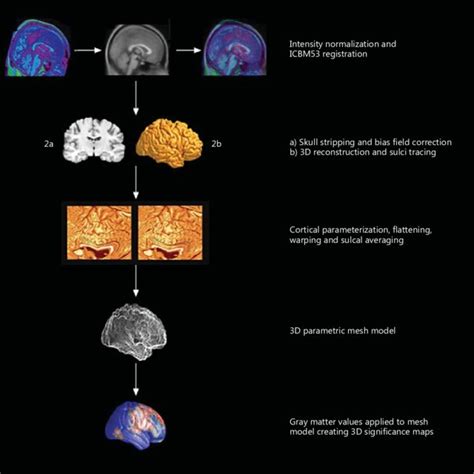 Cortical thickness analysis. | Download Scientific Diagram