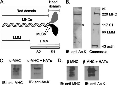 Hdac Dependent Reversible Lysine Acetylation Of Cardiac Myosin Heavy