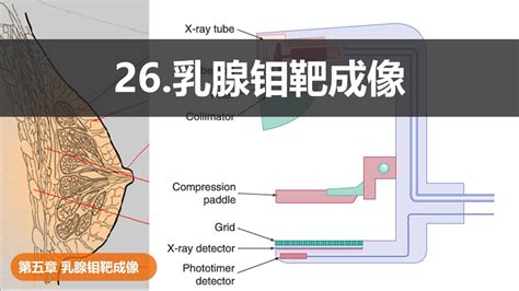 26 乳腺钼靶成像 爱影学苑联盟 爱影学苑联盟