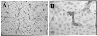 Morphology Of The Prostate Epithelial Cell Culture Gland Like Buds And