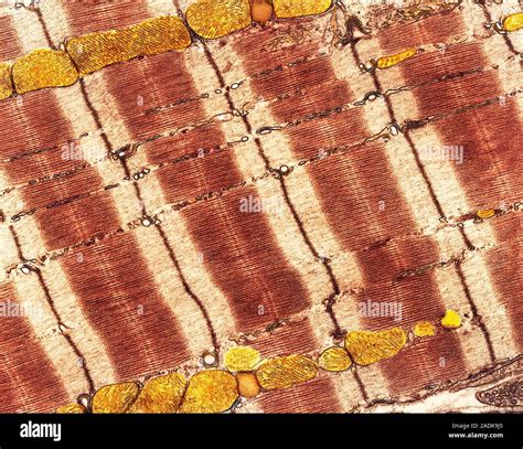 Cardiac Muscle Coloured Transmission Electron Micrograph Tem Of