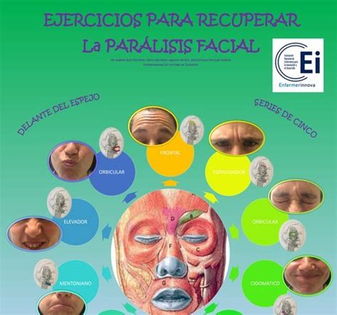 Ejercicios Para Recuperar La Par Lisis Facial Ocronos Off