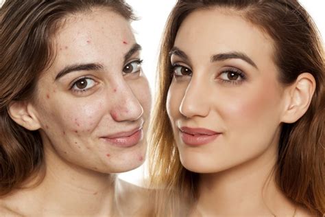 Quelle routine beauté pour un visage enfin sans imperfections