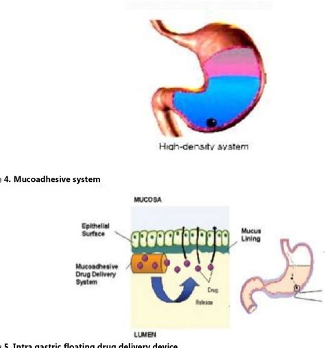 Figure From Gastroretentive Drug Delivery System An Overview