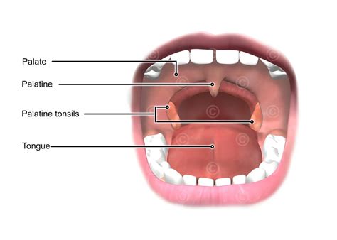 illustration anatomy tonsils medicalgraphics
