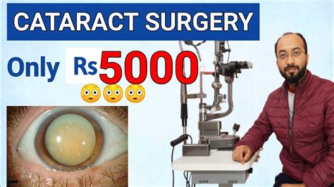 मोतियाबिंद ऑपरेशन का खर्चcataract Surgery Cost In India Cataract In