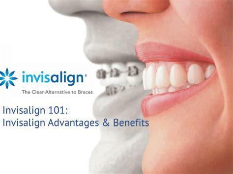 Ppt Invisalign 101 A Quick Overview From Orthodontics Limited