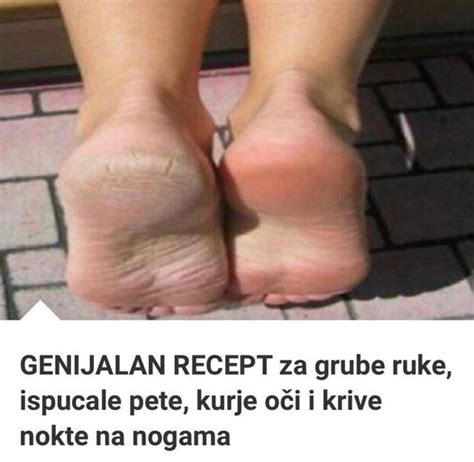 GENIJALAN RECEPT ZA GRUBE RUKE ISPUCALE PETE KURJE OČI I KRIVE NOKTE