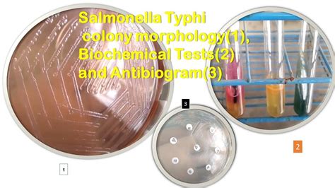 Salmonella Typhi Colony Morphology Biochemical Tests And Antibiogram