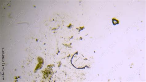 Microscope image footage of protozoa microorganisms in water, showing ...