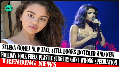 Selena Gomez New Face Still Looks Botched And New Holiday Look Fuels Plastic Surgery Gone Wrong