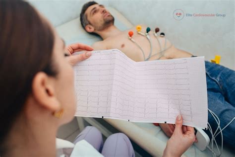 Electrocardiogram Ekg Elite Cardiovascular Group