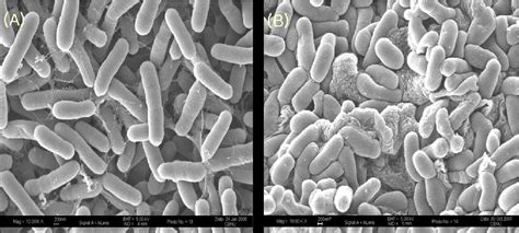 Figure 1 From A Novel Pink Pigmented Facultative Methylobacterium