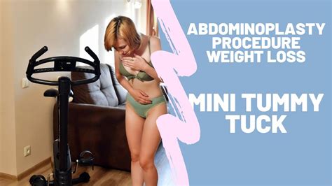 Abdominoplasty Procedure Weight Loss Mini Tummy Tuck 1 Youtube