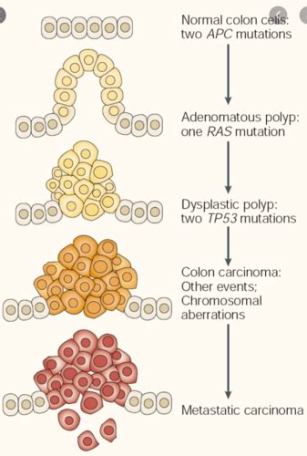 Gi Cancers Flashcards Quizlet