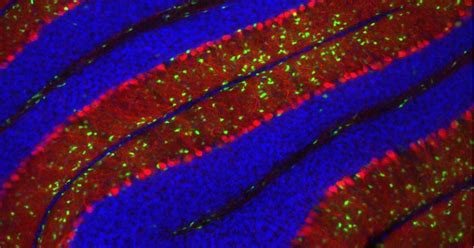 Neuronas De Purkinje Sus Funciones Y Caracter Sticas