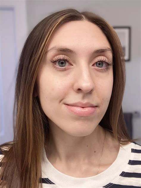 Lyma Laser Review: Lyma At-Home Anti-Aging Laser Review