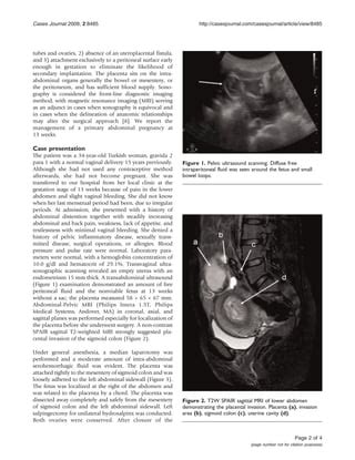 Journal Pdf