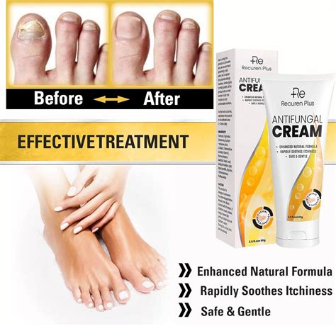 Antifungal Cream: Athletes Foot Treatment - Athletes Foot Cream- Ringworm Cream for Adults ...