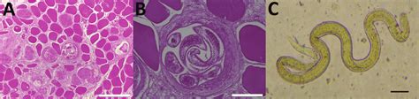 Trichinella Larvae Samples From Patients In Cambodia A Transverse