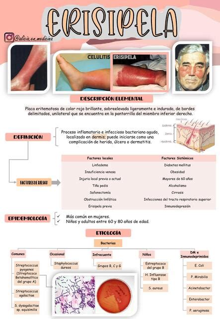 Erisipela Alicia En Medicina By Gabriela Soplin Villacorta UDocz