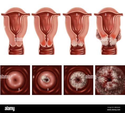 The Cervical Hi Res Stock Photography And Images Alamy