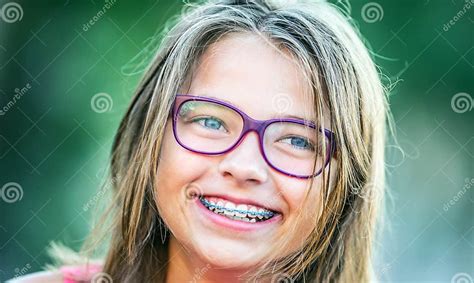 Fille De Sourire Heureuse Avec Des Bagues Dentaires Et Des Verres