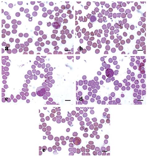 Mgg Quick Rapid Staining Of Leukocytes Present In The Peripheral Blood