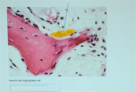 Solved Pal Histology Connective Tissue Lab Practical Chegg