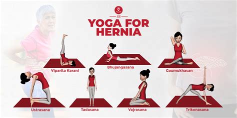 Yoga For Hernia Effective Yoga Poses You Should Try Artofit