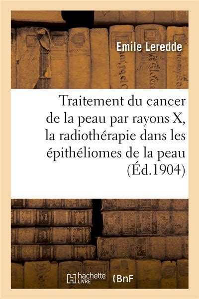 Traitement Du Cancer De La Peau Par Les Rayons X La Radioth Rapie Dans