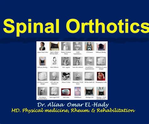 Spinal Orthosis Dr Aliaa Ppt