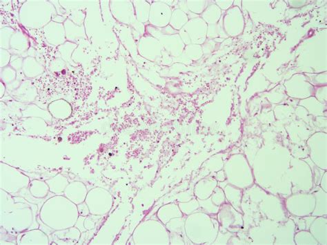 Histologia Do Tecido Adiposo Humano Foto De Stock Imagem De Humano