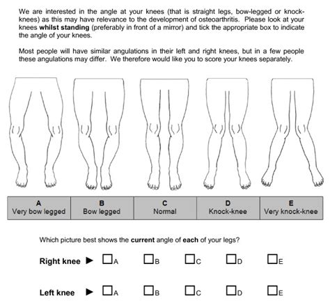 Novel Self Report Instrument For Assessment Of Knee Malalignment