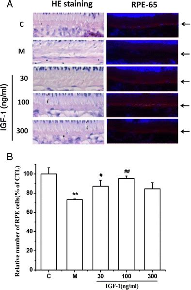 Effects Of Igf On The Morphological Changes Rpe Expression And